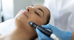 Microneedling results